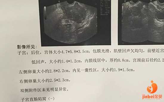 上海医院供卵要等吗,【上海供卵不用等的医院】但是建册不是说前三个月建册